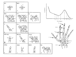 Iranian Journal Of Radiology Comparative Evaluation Of The