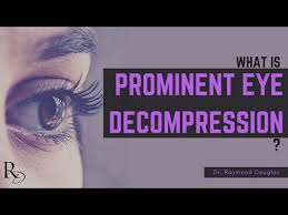 Thyroid Eye Disease Caused By Graves A Search For Treatment After Spending Years Hiding At Home This Photographer Shares How She Finally Gained Relief From The Painful And Embarrassing Symptoms Caused