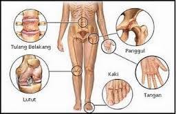 Yang terbaik ialah berjumpa doktor di klinik atau. Tanda Tanda Anda Mengidap Gout Yang Serius Pengedar Shaklee Alor Setar