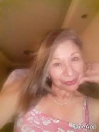 Las líneas de marioneta son los surcos que se forman a través de los años  de las comisuras de los labios hacia el mentón, y podemos rellenarlos con  ácido hialurónico para dar