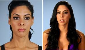People Call Me Pig Nose Miss India Begs Surgeons To Fix Her Huge Nostrils Weird News Express Co Uk