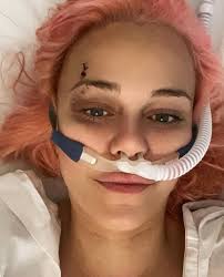 Today marks 3 years since the hit-and-run car accident that broke my body  and completely changed my life. And today is the last year I will mark this  date