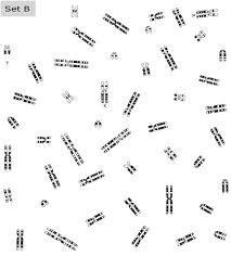 Student exploration human karyotyping gizmo answer key. Download Human Karyotyping Set B Answer Key Vol 0 1 5th Epub Specifications Free