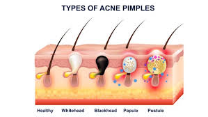 Changes have even occurred in the color of our skin. Skin Glow Electric Cleanser Blackhead Remover Review Mamabella