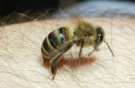 Bienen Wespen Und Hornissen Wie Gefahrlich Sind Insektenstiche Wissen Stuttgarter Nachrichten
