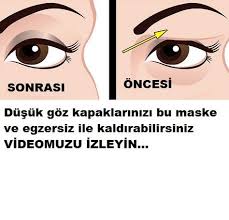 Dusuk Goz Kapaklari Kaldiran Yontem Bu Yontem Ile Ayrica Bu Maske Ile Goz Kapaklarinizi Kaldirabilirsiniz Videolu Eyelid Lift Face Acne Face Mapping Acne