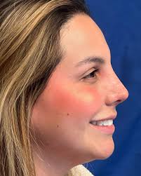 Dr. Mario Botero Ramirez (@marioboteroramirez) • Instagram photos and videos