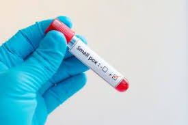 After one of them contracted monkeypox while abroad, public health wales (phw) confirmed that two members of the same family had developed the disease, which causes pains, fever, and a scabby rash. Uk Orders Smallpox Vaccine In Response To Monkeypox Occurrences Bioprocess Internationalbioprocess International