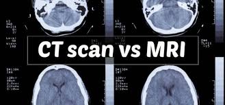 We are experienced in providing veterinary care for a number of clinical dog and cat conditions. Cost Of A Cat Scan Difference Between Ct And Mri Scan 730x340 Cat And Dog Lovers