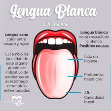 Clinic Sax La Lengua Blanca Se Produce Como Resultado Facebook