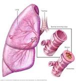 Image result for icd 10 code for chronic obstructive asthma