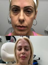 Aquamarinemedspa/Elevated Beauty (@aquamarineaesthetics) • Instagram photos  and videos