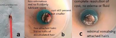 Image result for Umbilicus botryoides