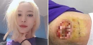 한예슬 수술 집도의와 병원 측이 공식 사과를 했지만 논란은 잠재워지지 않는 상황이다. í•œì˜ˆìŠ¬ ì˜ë£Œì‚¬ê³  ê³¼ì‹¤ ì¸ì •ê³¼ ì‚¬ê³¼ë°›ì•˜ë‹¤ í–¥í›„ ê¸ˆì „ì  ë°°ìƒ ìˆ˜ì¤€ì€ Sbs ë‰´ìŠ¤
