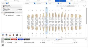 Supernumerary Tooth Numbering Chart Related Keywords