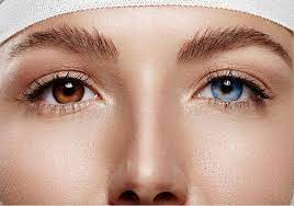 Cambio De Color De Ojos Con Laser Centros Ideal