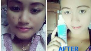 Cara mengurangi minyak di wajah yang cukup sederhana namun kerap dilupakan adalah menjaga kulit tetap kering. Untuk Yg Terkena Cipratan Minyak Di Wajah Ini Dia Solusinya Youtube