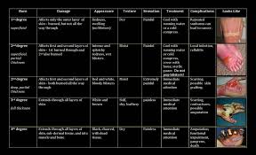 treatment burn injury answers burn injury answers