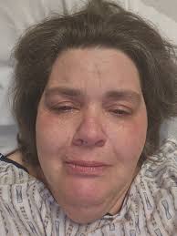 OMG!!! THE PAIN IS UNBEARABLE!! PLEASE PRAY FOR ME!!!