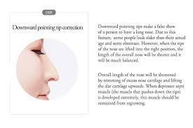 A bulbous, round nasal tip is a direct result of the shape of the lower lateral cartilages. Downward Pointing Tip Correction Answer Plastic Surgery