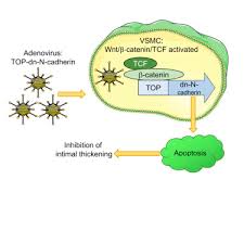 We did not find results for: Targeting Wnt B Catenin Activated Cells With Dominant Negative N Cadherin To Reduce Neointima Formation Molecular Therapy Methods Clinical Development