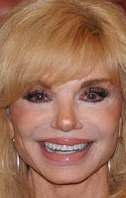 Лони Андерсон