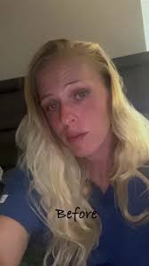 skincare #skincareroutine #skincaretips #glowingskin #skincarepro...