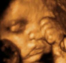 3d/4d ultrasound in brooklyn, ny. 9 4d Ultrasound In Brooklyn By 1st Glimpse Ideas 4d Ultrasound 3d Ultrasound 3d Ultrasound Pictures