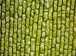 Elodea In Hypotonic Or Isotonic Solution The Cell Microscopic Cell