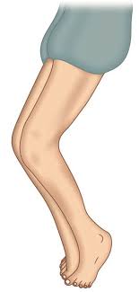 Loss of blood supply to the bone: Jaypeedigital Ebook Reader