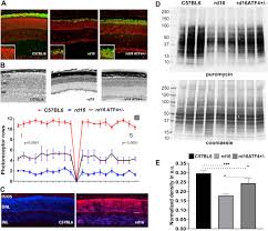 Endoplasmic Reticulum Stress New Insights Into The Pathogenesis And Treatment Of Retinal Degenerative Diseases Sciencedirect