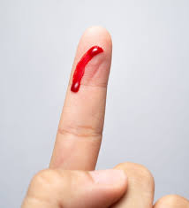 Dès que vous vous tachez d'encre, la première chose à faire est de presser un papier voici les 10 meilleurs trucs pour enlever une tache d'encre sur un vêtement, sur un tapis et sur le cuir. Faire Disparaitre Une Tache De Sang