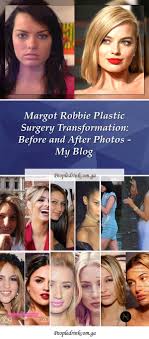Pin On Plastic Surgery