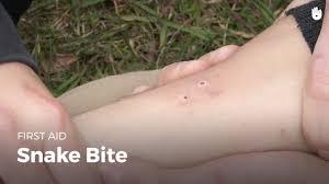 That is not a pit viper. Learn First Aid Gestures Snake Bite Youtube