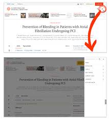 「Be the first to comment on this video Add Video to Your Blog ~gastrointestinal」的圖片搜尋結果