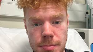 Man in toilet 30 times a day as rash found not to be food poisoning