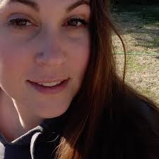 Has anyone had HS and recurring polynidal cyst surgery?