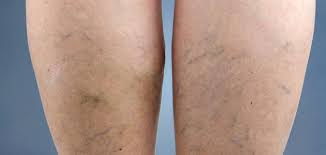 Check spelling or type a new query. Ø¯ÙˆØ§Ù„ÙŠ Ø§Ù„Ø³Ø§Ù‚ÙŠÙ†