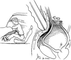 Image result for Genitourinary Trauma