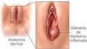 Scheresse vaginale : un large choix de traitements