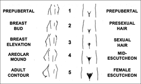 Stages Of Breast And Pubic Hair Development Stage 1 Is Prepubertal Download Scientific Diagram