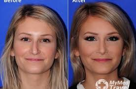 A. Joshua Zimm MD. Facial Plastic & Reconstructive Surgery