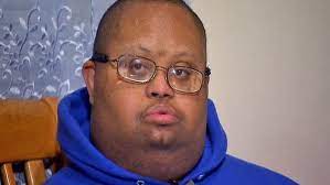 Black infants with down syndrome have a lower chance of survival so that's why you don't see as many black people with down syndrome, they did down syndrome does not occur in one race more than another. in the united states, however, black or african american infants with down. Pin On Down Syndrome