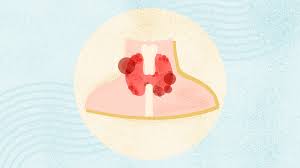 Image result for Thyroiditis