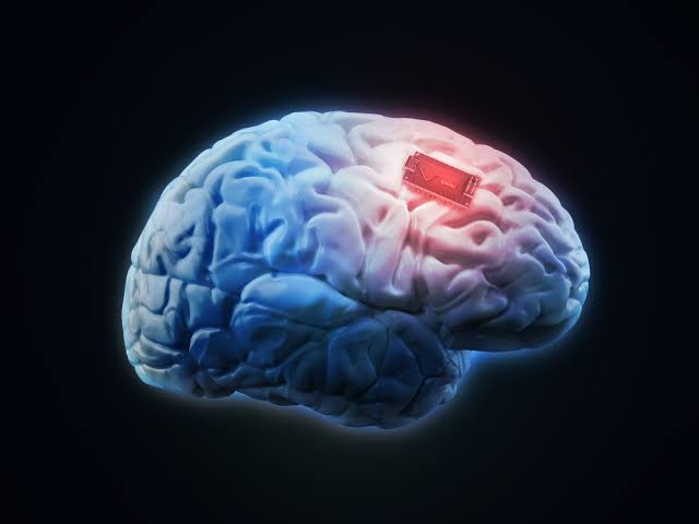Brain Implant Could Help People With Memory Loss
