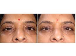 City Light Skin Clinic