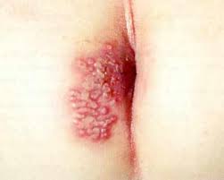 Fmpmc Ps Gynecologie Niveau Dcem2
