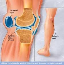 Pin On Food For A Faster Acl Recovery
