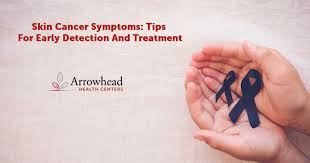 Skin cancer is an abnormal growth of cells on top layers of the skin, most often attributed to sun exposure. Skin Cancer Symptoms Tips For Early Detection And Treatment Redirect Health Centers