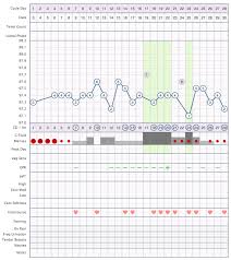 Anovulatory Cycles Ovagraph